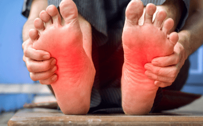What Can You Do to Relieve Foot Arthritis Pain?
